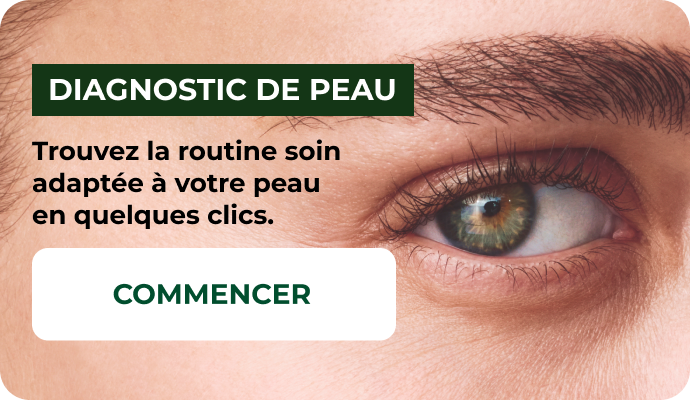 Diagnostic de peau yves rocher